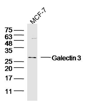 Galectin 3 Rabbit Polyclonal Antibody
