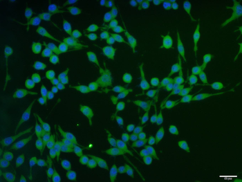 Caspase-8 subunit p10 Rabbit Polyclonal Antibody