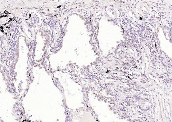 PGP9.5 Rabbit Polyclonal Antibody