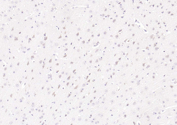PGP9.5 Rabbit Polyclonal Antibody