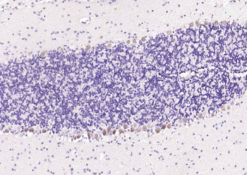 PGP9.5 Rabbit Polyclonal Antibody