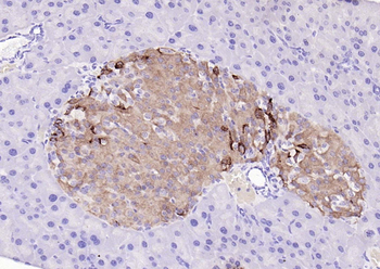 PGP9.5 Rabbit Polyclonal Antibody