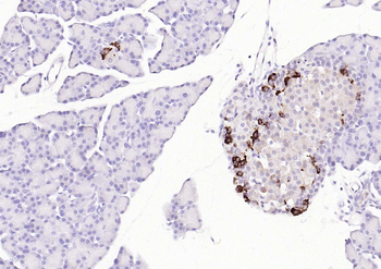 PGP9.5 Rabbit Polyclonal Antibody