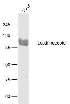 Leptin receptor Rabbit Polyclonal Antibody