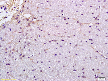 Claudin 5 Rabbit Polyclonal Antibody