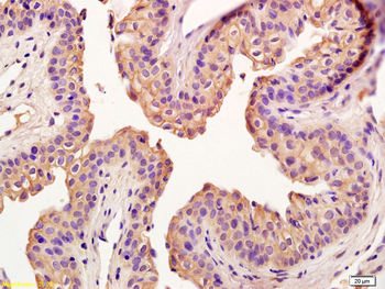 Claudin 5 Rabbit Polyclonal Antibody