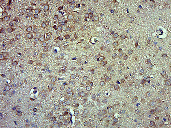 PEDF Rabbit Polyclonal Antibody