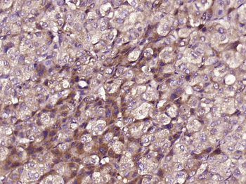 MPO Rabbit Polyclonal Antibody