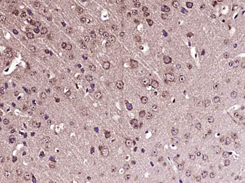 Tubb3 Rabbit Polyclonal Antibody