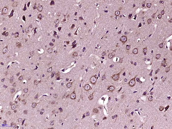 Tubb3 Rabbit Polyclonal Antibody