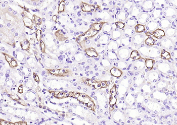 AQP1 Rabbit Polyclonal Antibody