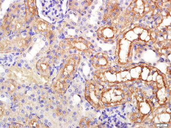 AQP1 Rabbit Polyclonal Antibody