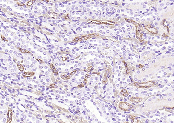 AQP1 Rabbit Polyclonal Antibody