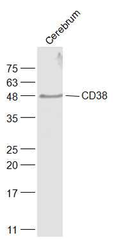 CD38 Rabbit Polyclonal Antibody