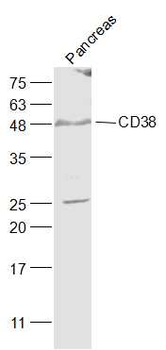 CD38 Rabbit Polyclonal Antibody