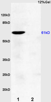 OAT1 / SLC22A6 Rabbit Polyclonal Antibody