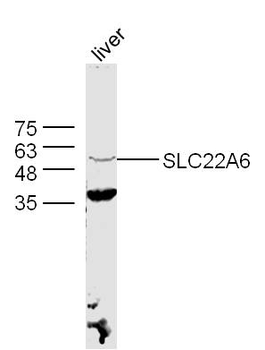 OAT1 / SLC22A6 Rabbit Polyclonal Antibody