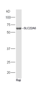 OAT1 / SLC22A6 Rabbit Polyclonal Antibody