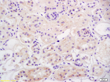 OAT1 / SLC22A6 Rabbit Polyclonal Antibody