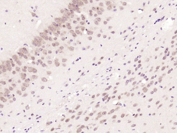INOS Rabbit Polyclonal Antibody