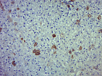 INOS Rabbit Polyclonal Antibody