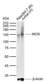 INOS Rabbit Polyclonal Antibody