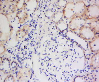 INOS Rabbit Polyclonal Antibody