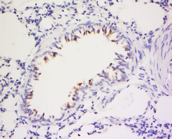 INOS Rabbit Polyclonal Antibody