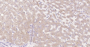 MRP2/ABCC2 Rabbit Polyclonal Antibody