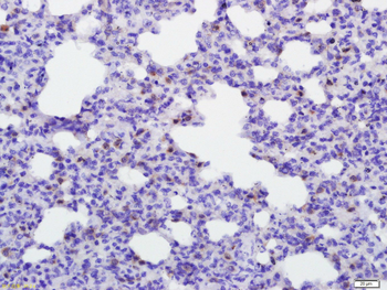 IFN gamma Rabbit Polyclonal Antibody