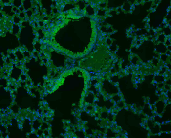 IFN gamma Rabbit Polyclonal Antibody