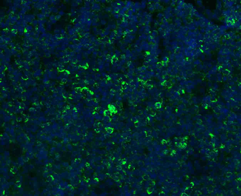 IFN gamma Rabbit Polyclonal Antibody