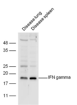 IFN gamma Rabbit Polyclonal Antibody