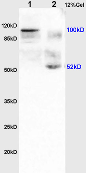 N-cadherin Rabbit Polyclonal Antibody
