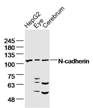 N-cadherin Rabbit Polyclonal Antibody