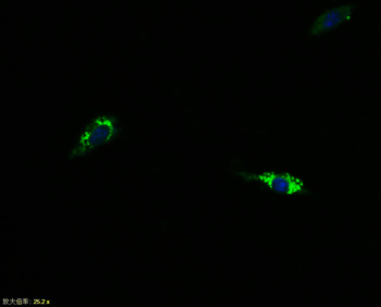 N-cadherin Rabbit Polyclonal Antibody