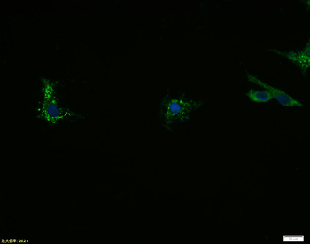 N-cadherin Rabbit Polyclonal Antibody