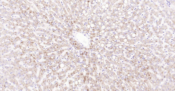 CYP7A1 Rabbit Polyclonal Antibody