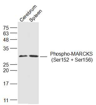 Phospho-MARCKS (Ser152 + Ser156) Rabbit Polyclonal Antibody (HRP)
