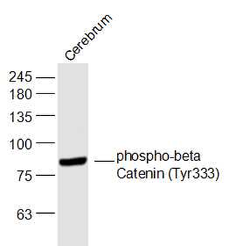 Phospho-beta Catenin (Tyr333) Rabbit Polyclonal Antibody (HRP)