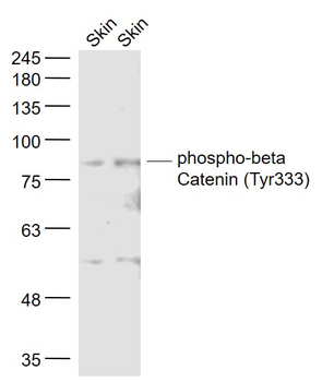 Phospho-beta Catenin (Tyr333) Rabbit Polyclonal Antibody (HRP)