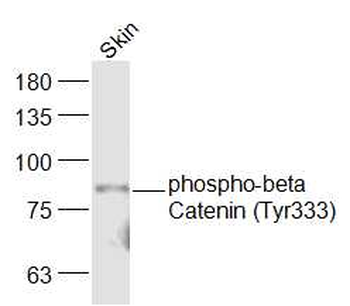 Phospho-beta Catenin (Tyr333) Rabbit Polyclonal Antibody (HRP)