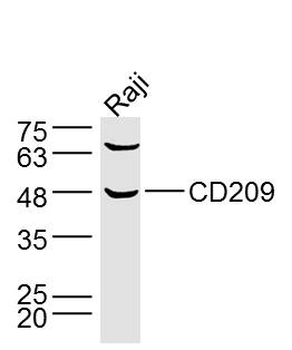 CD209/DC-SIGN Rabbit Polyclonal Antibody
