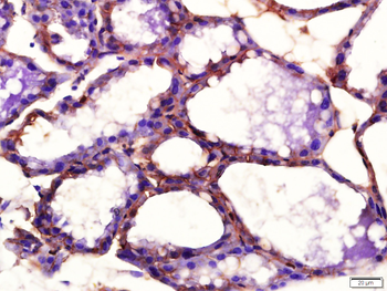 Phospho-PDGFRA (Tyr754) Rabbit Polyclonal Antibody