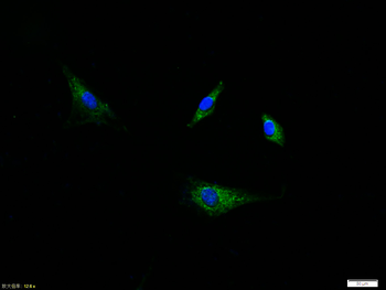 Phospho-PDGFRA (Tyr754) Rabbit Polyclonal Antibody