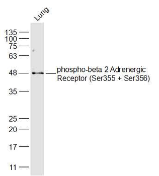 Phospho-ADRB2 (Ser355 + Ser356) Rabbit Polyclonal Antibody