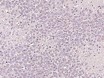 Phospho-TUBB3 (Ser172) Rabbit Polyclonal Antibody