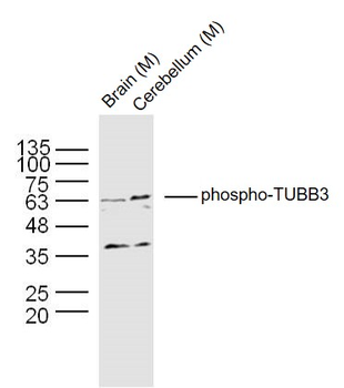 Phospho-TUBB3 (Ser172) Rabbit Polyclonal Antibody