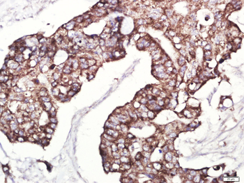 Phospho-IRAK1 (Thr209) Rabbit Polyclonal Antibody