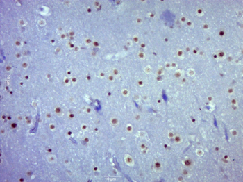 Phospho-STAT3 (Tyr705) Mouse Monoclonal Antibody